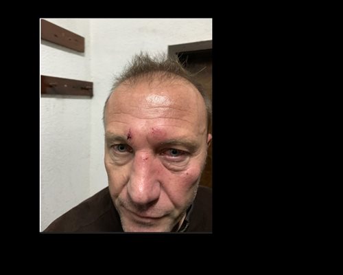 Красимир Папазов е удрян в лицето
