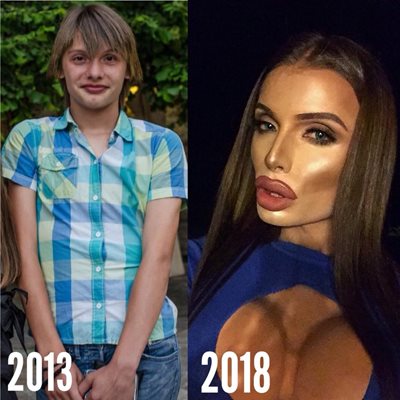 Преди и след