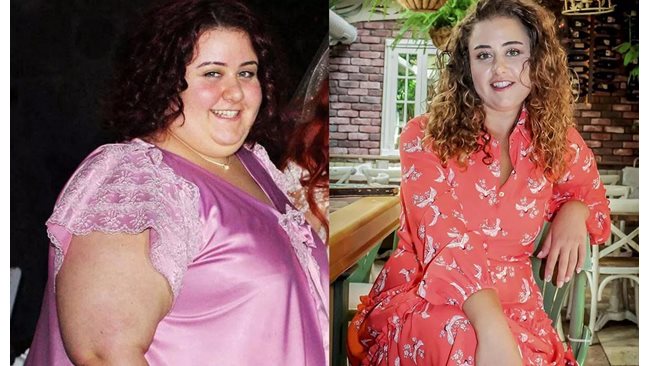 Melike from “Vyatarnichav” lost 100 kg after several operations