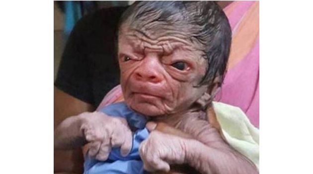 Бебето с лице на възрастен Факсимиле: Daily Mail