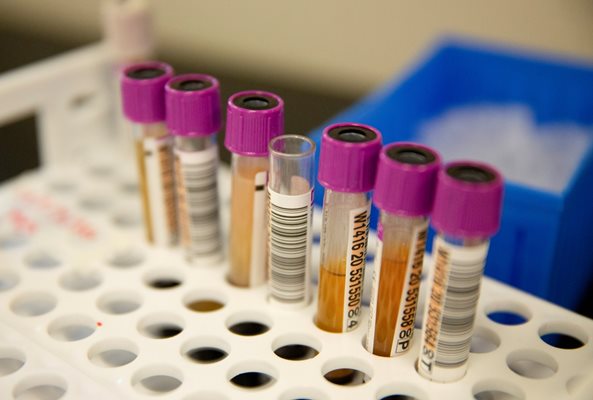 Кръвни проби чакат да бъдат изследвани за наличие на антитела.

