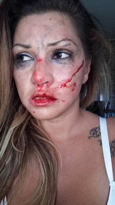 Сани Алекса няколко часа след зверския побой от бившия й приятел. Снимка: Фейсбук