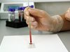 Кръвта на пациент може да се окаже новото оръжие срещу ХИВ