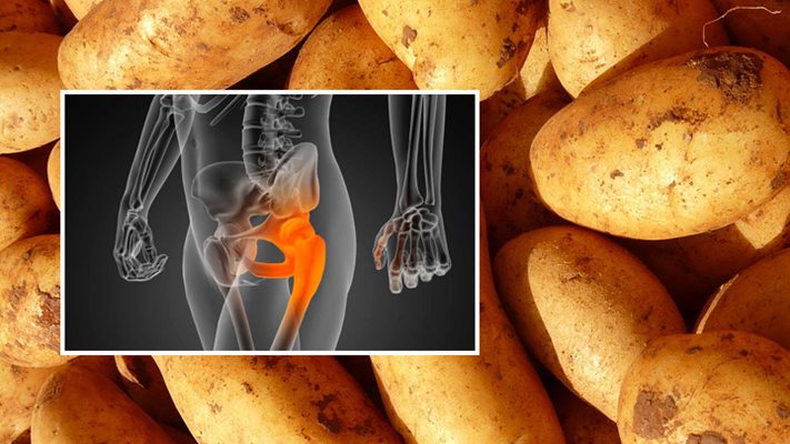 Картофите - мощен цяр за коксартроза и артрит