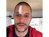 Футболист с 4 шева на главата след побой в Несебър, спряха мач на полувремето