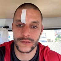 Футболист с 4 шева на главата след побой в Несебър, спряха мач на полувремето
