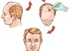 Присаждане на коса - нова процедура в клиниката за пластична хирургия на д-р Николай Георгиев