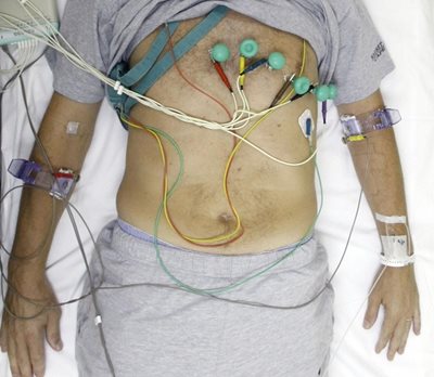 По 4 енергийни напитки на ден приземиха мъж в болница със сърдечен проблем