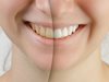 Избелване на зъби в домашни условия с активен въглен