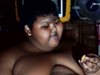 Най-дебелото дете в света свали 31 от своите 190 кг (Видео)