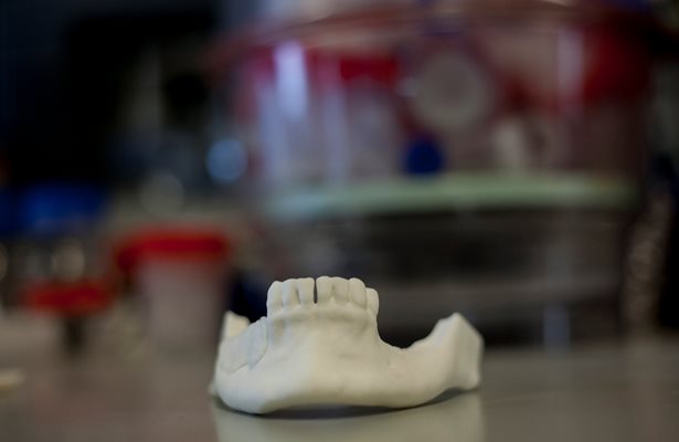 Екипът произвежда и челюсти от биоматериали, които могат да се имплантират по хирургичен път при катастрофирали или пациенти с тумори.