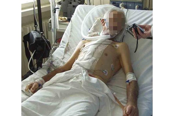Пациент, спасен със сърдечна операция в болница "Св. Екатерина". 
СНИМКА: СИЛВИЯ ГУРМЕВА