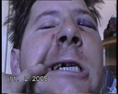 След побоя Якимов помолил своя приятелка да го снима с камера, за да се видят избитите зъби и синините. Записът е приложен като доказателство по делото.