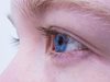 Какво се прави при болест на Фукс и катаракта?