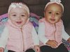 Жена роди близначки с различен цвят на кожата (Снимки+Видео)