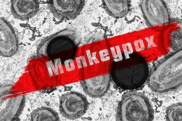 Великобритания може да остане без ваксини срещу маймунска шарка в края на месеца