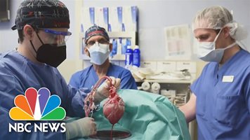 Първа успешна трансплантация на сърце от прасе на човек (Видео)
