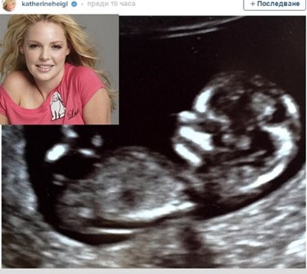 Факсимиле от Инстаграм на снимка от ултразвук, с която Катрин Хейгъл обяви, че е бременна през юни