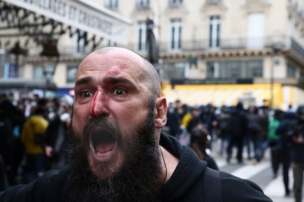 Французин е с окървавено лице след протестите.