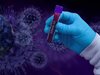 За пръв път над 30 000 заразени с коронавирус само за 24 часа във Франция