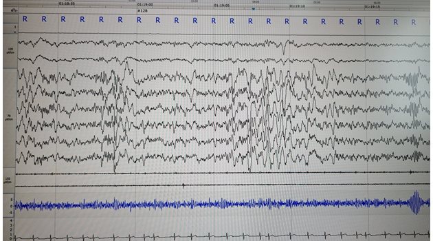 Данните за работата на мозъка са снети със съвременна апаратура. 
СНИМКА: ЛИЧЕН АРХИВ НА Д-Р НЕЙКО НЕЙКОВ