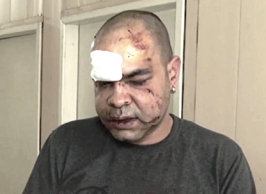 През януари тази година 37-годишен медицински брат от Враца бе зверски пребит с юмруци