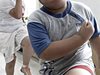 Затлъстяването е много разпространено сред децата в Южна Европа