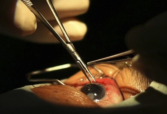 Нова терапия използва уникален термогел, за да пази ретината от белези