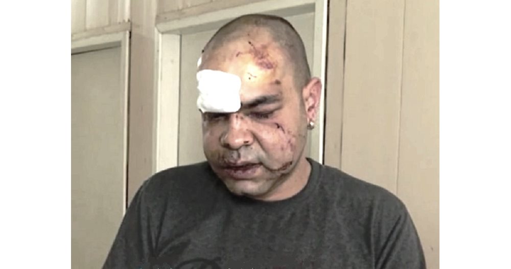 The man arrested for beating the medic in Vratsa was at the protests in front of the emergency center (Obzor)