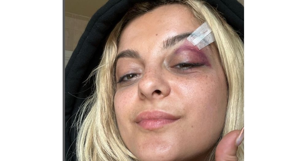 Bibi Rexha Injured at New York Concert: Shocking Video Footage. Find out who attacked her!