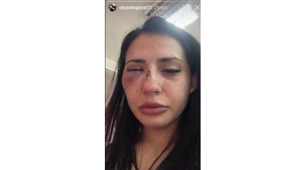Оля, която е връстничка на Боряна, показа в Инстаграм подпухналото си бой лице