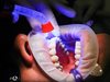 Мъж със силен зъбобол се самоуби, чакал месеци да му извадят мъдрец по Здравна каса във Великобритания