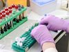 Франция с рекордни над 20 000 нови случаи на коронавирус за денонощие