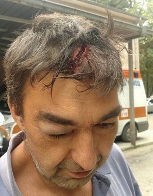 Емил Марков е със счупен череп след побоя