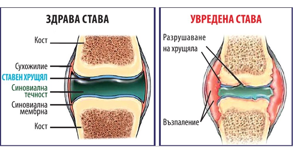 Хруст полового члена во время полового акта - Урология - 10 мая - Здоровье ithelp53.ru