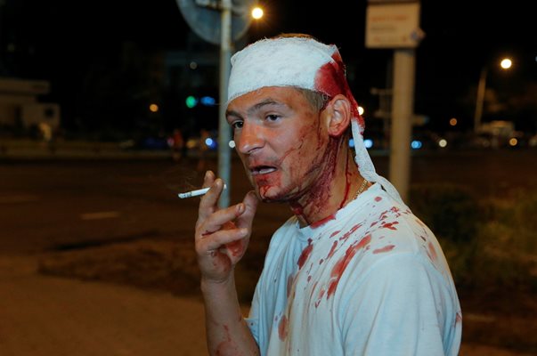 Ранен мъж пуши цигара по време на митинга след президентските избори в Минск. Снимки: Ройтерс