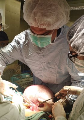 Екипът по време на операцията, който отстрани огромния тумор от яйчника на 62-годишната пациентка.