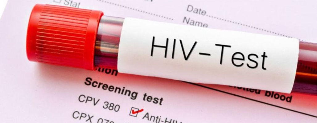 Изследователи са елиминирали ХИВ от клетки в лабораторни условия