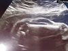 Млада жена в САЩ е "бременна с автомобил" (видео)