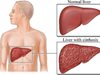 Какво се случва, когато черният дроб и жлъчката не функционират правилно