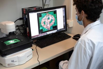 Учен разглежда микроскопско изображение на кръвоносен съд, заобиколен от ракови тъкани, като част от изследване на рака на мозъка. СНИМКА: РОЙТЕРС