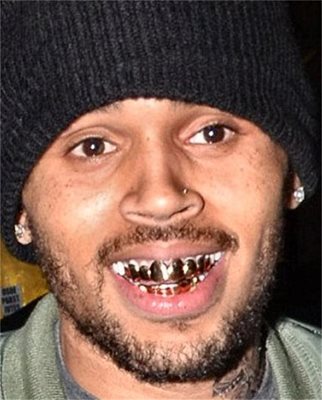Крис Браун има различни видове - златни за долните зъби, само за един златен зъб и т.н. 
СНИМКИ: РОЙТЕРС, IAMBEYONCE.COM