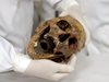 Студенти в Бразилия ще учат по скелета на Менгеле
