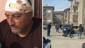 Пострадал при масовия бой в Казанлък: Нападнаха ме, щом излязох от колата