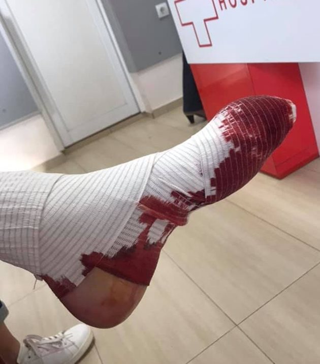 Кадър с окървавената превръзка пусна във фейсбук сестрата на Апостол Господинов. Снимка:фейсбук