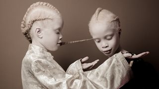 Близначки албиноси завладяха модата с уникалната си красота (галерия)