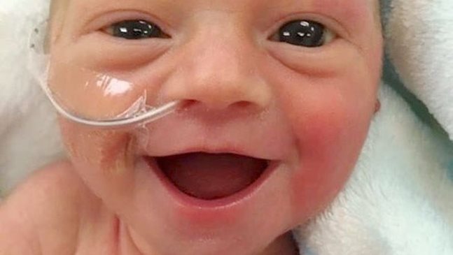 Недоносено бебе се усмихва 5 дни след раждането си