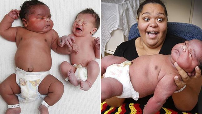 Жена роди близо 7-килограмово бебе без упойка