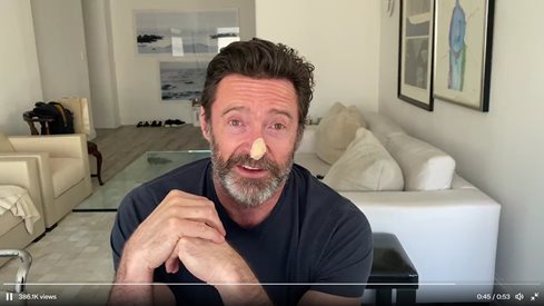 Хю Джакман с превръзка на носа: Страхува се от нов рак на кожата (Видео)