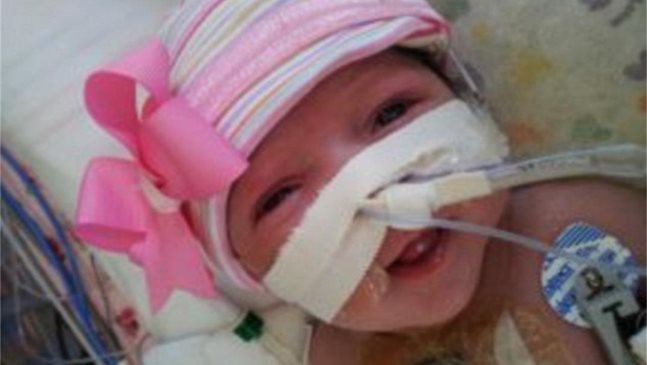 Спасиха момиченце, родено със сърце извън тялото, в Тексас (видео)